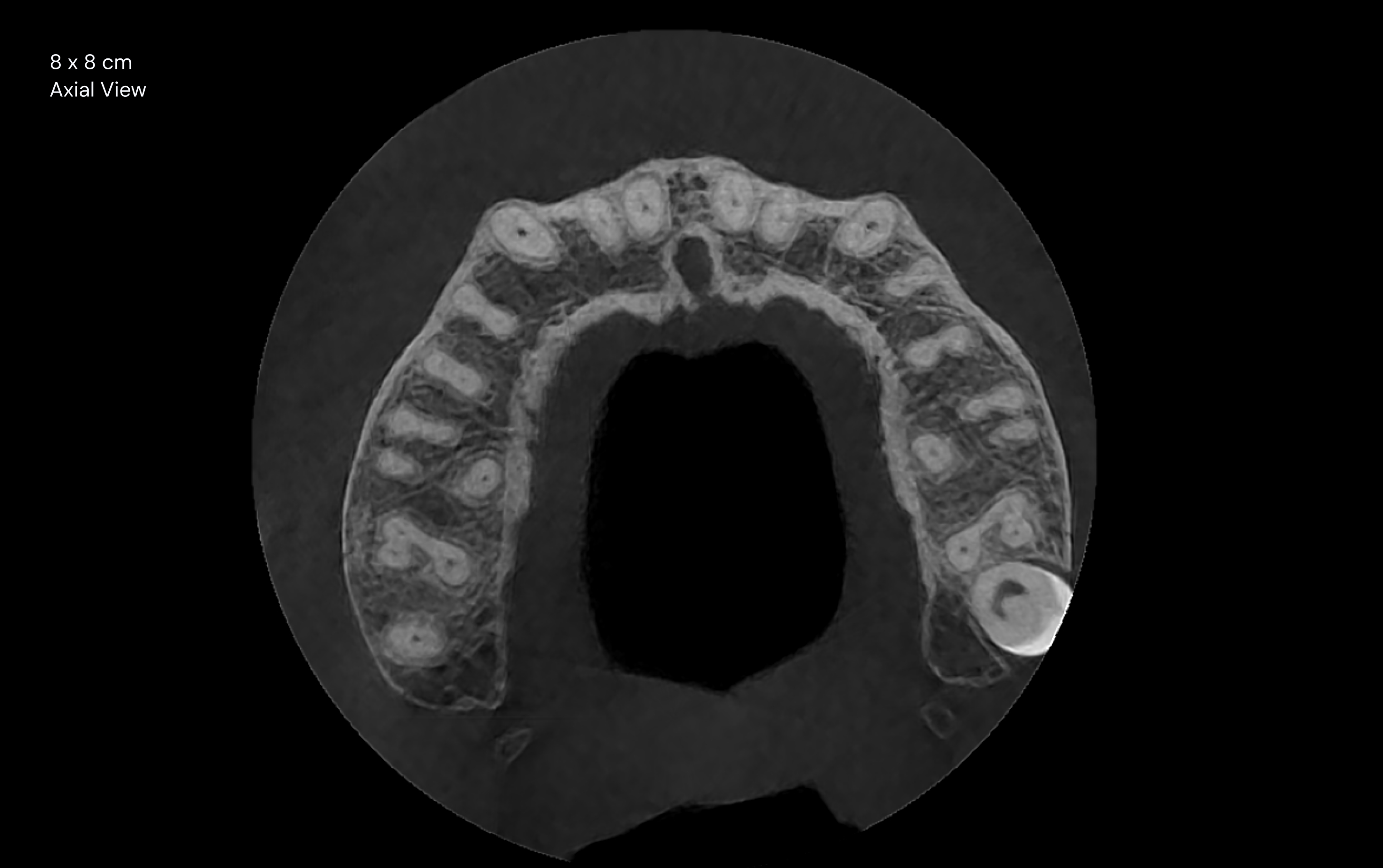 8 x 8 cm Axial View